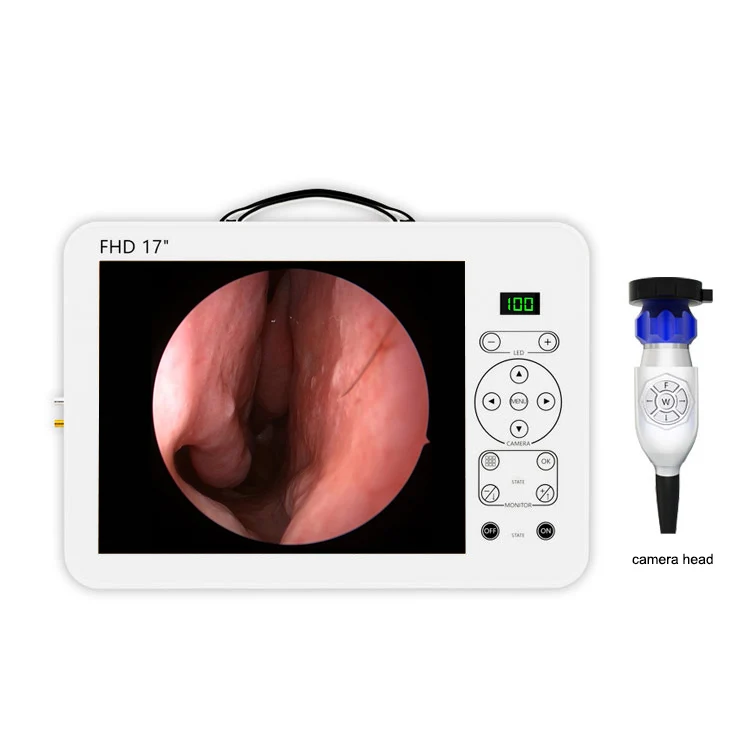 17 Inch HD Video Otoscope ENT  - Medical Lab Images recension och pris